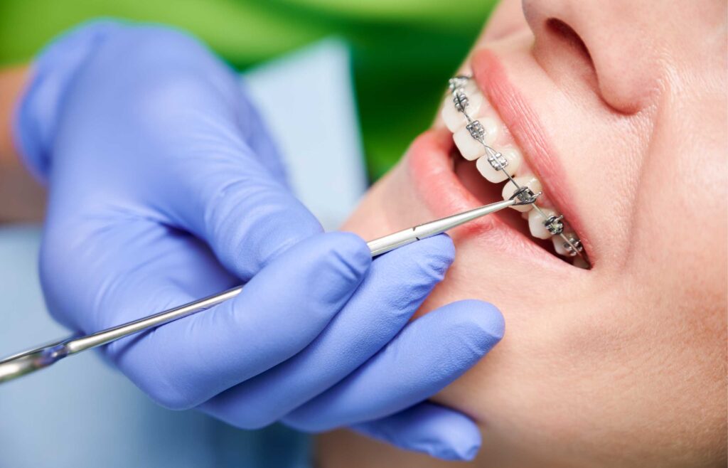 orthodontische training